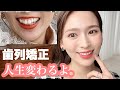 【歯列矯正】矯正して顔は変わる？本当にやってよかった🦷✨/経過/痛み/費用