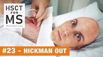 HSCT for MS Vlog #23 - Hickman Out!