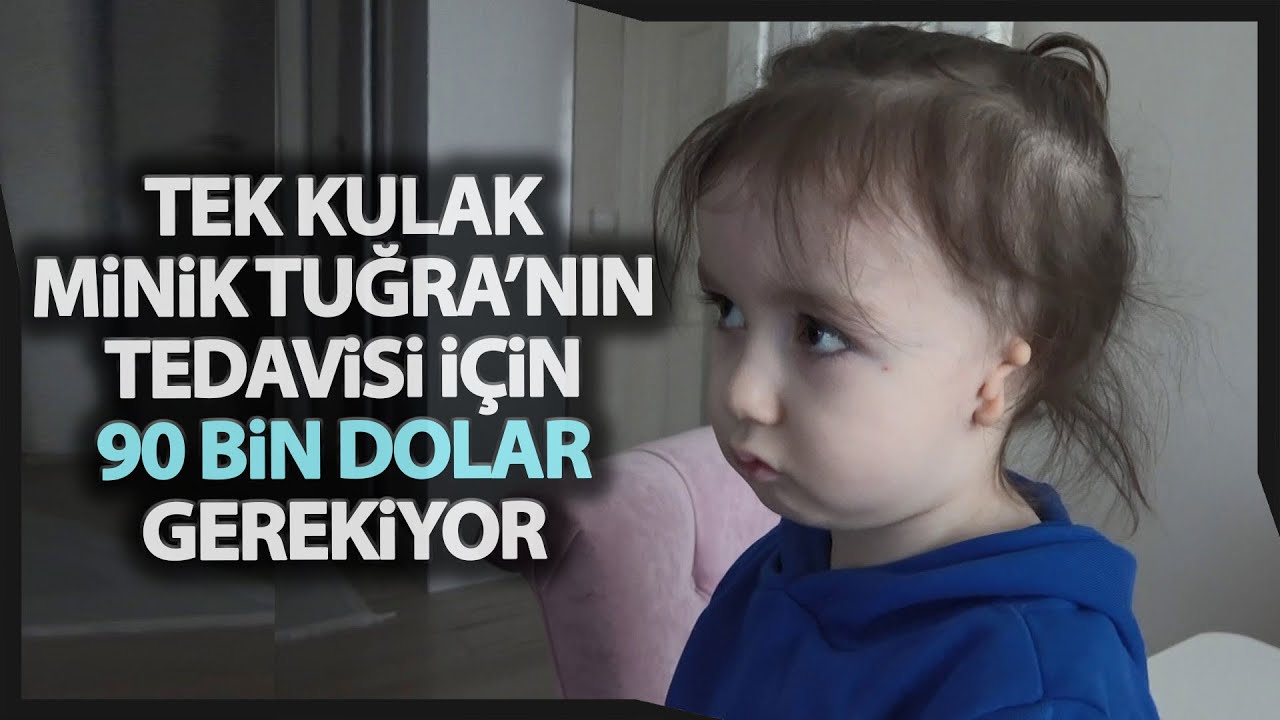 'Kulak Yokluğu' (Microtia) Hastası Minik Tuğra’nın Ailesi Tedavi İçin Yardım Bekliyor