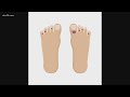 Good 'COVID toes' treatments still developing | Health Beat