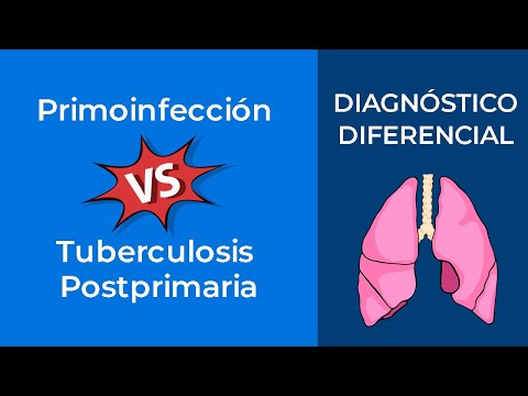 Vídeo: TB Miliar: Diagnóstico Diferencial, Vs. Tuberculosis Pulmonar, Más