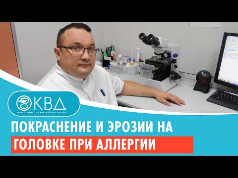 😟 Покраснение и эрозии на головке при аллергии. Клинический случай №1058