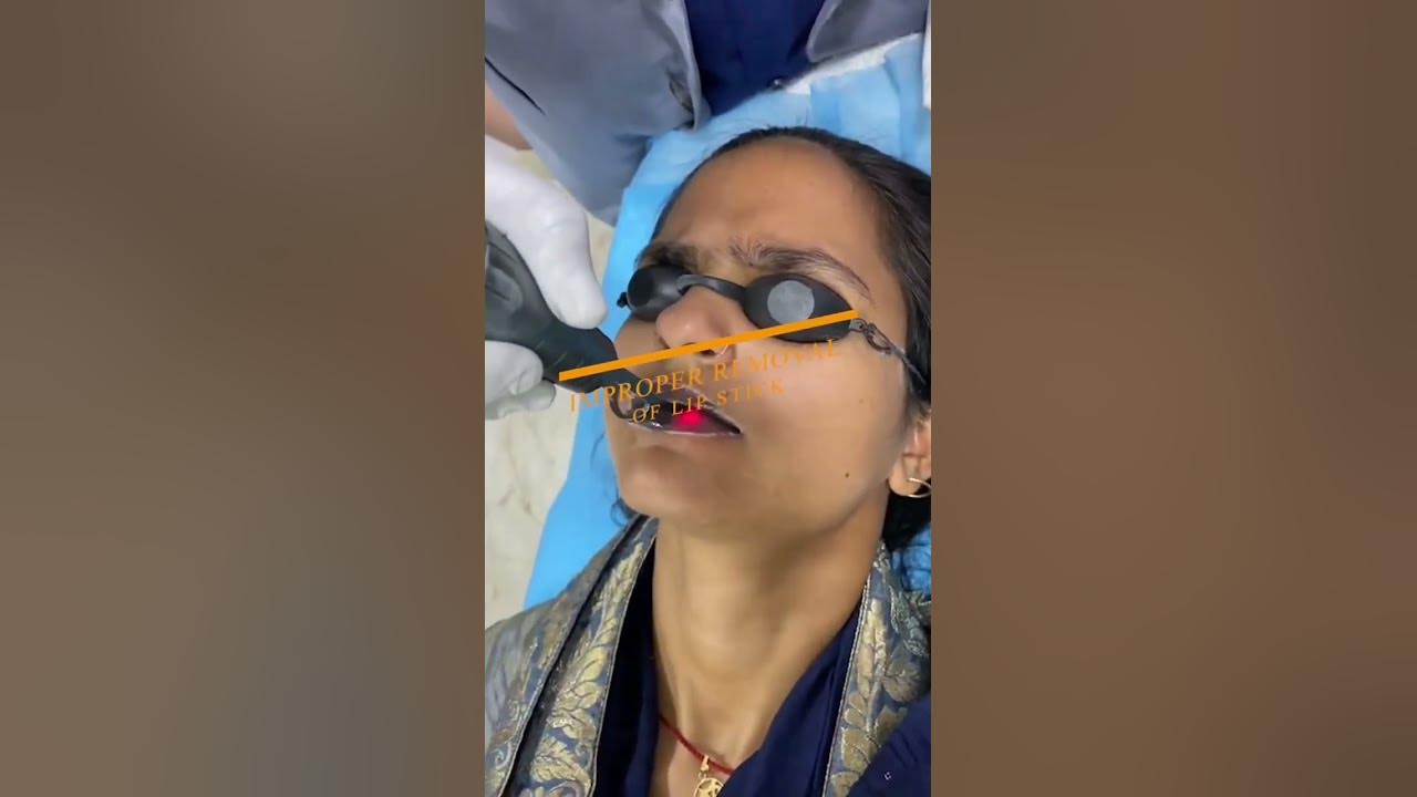 worried-about-dark-lips-try-laser-treatment-for-lip-pigmintation-youtube