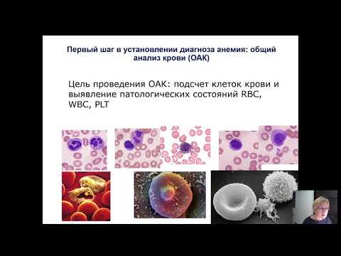 Анемия, общие сведения, дефицитные анемии