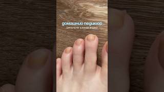 Домашний педикюр лучше салонного 🦶🏼🧴 крем для ног: 124736678 РП