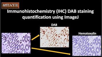 Immunohistochemistry (IHC) DAB staining quantification using ImageJ