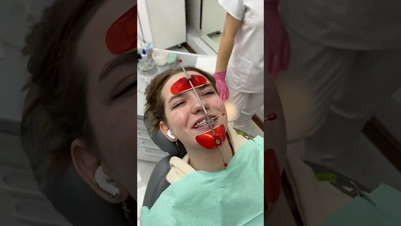 The WORST Orthodontic Appliance EVER! 😭🦷
