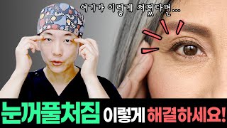 눈꺼풀 처짐 고민 영상 1개로 이렇게 해결하세요! 눈꺼풀 처짐개선법 4가지! 처진눈꺼풀 진단법 | Four Perfect Ways to Improve Your Eye Sagging