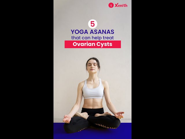 Yoga Poses and Pranayama Exercises to Treat Ovarian Cyst - Fitsri Yoga