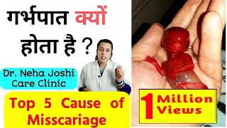 Miscarriage Causes | Symptoms | हिंदी | Miscarriage in Pregnancy |#nehajoshi #miscarriage
