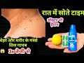 तिल और मस्से को जड़ से ख़त्म करने का सबसे अच्छा उपाय Remove Skin Tag Naturally