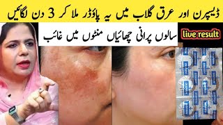 Disprin Tablet for Skin pigmentation and anti acne | Get Beautiful, soft, spotless and glowing skin