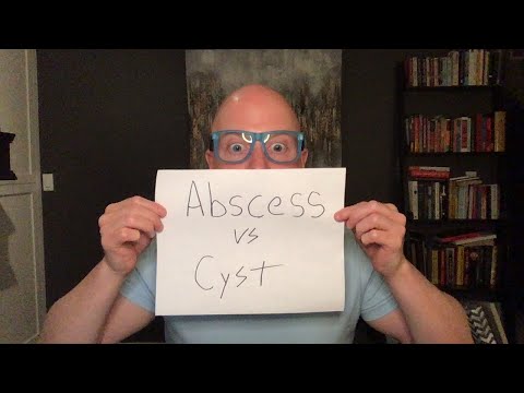 Abscess Vs Cyst. मेरे पिछले वीडियो के बारे में अनेक प्रश्नों का उत्तर देना। इसके अलावा क्या जल्द ही आ रहा है!