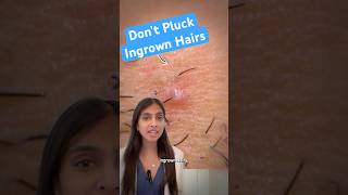 Dont Pluck Ingrown Hairs