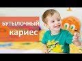 Бутылочный кариес. 🍼 Что такое бутылочный кариес. Мать и Дитя