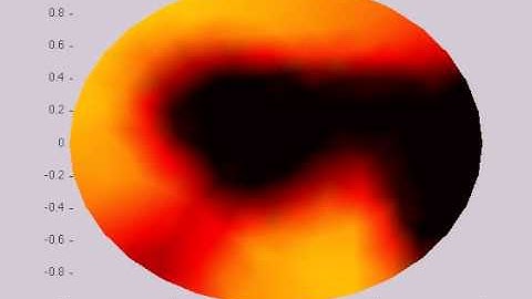 Dr. Youngmah || Simulation of F-actin Waves on 2D cell showing reflecting waves