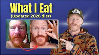 13 Years Eczema Psoriasis Free My Daily Diet, Macros Staple Foods