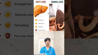 Fatty Liver Kya Hota Hai ? Symptoms Causes Treatment | Dummy Liver Model Used