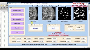 Matlab Code For Type of Breast Cancer Detection Using Image Processing