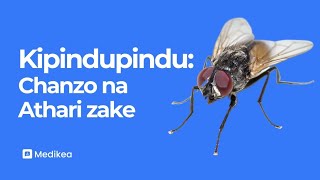 KIPINDUPINDU (CHOLERA) Dalili, Madhara na jinsi ya Kujikinga