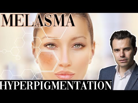 Vidéo: Remèdes Maison Melasma: Aloe Vera, Glutathion, Acide Tranexamique