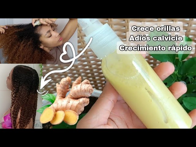 Rizos y Crespos ®  Chiriquí on Instagram: Si buscas un aceite que te  ayude a estimular el crecimiento y a mantener un cabello sano, este aceite  de @mielleorganics es para ti.