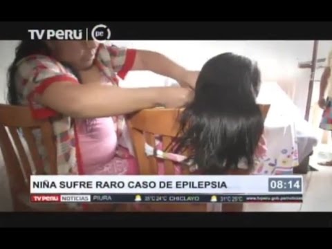Video: Una Niña Con Epilepsia Recibió Ayuda En El OKB # 2 De Tyumen