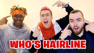 WHOSE HAIRLINE IS IT ANYWAY?