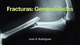 Fractures: Generalities