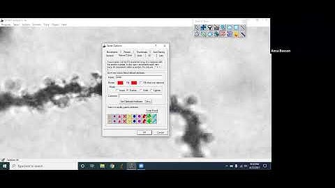 Dendritic Spine Analysis in RECONSTRUCT