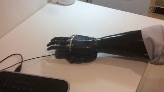 Milmi InovaMilmi inc The first bionic hand prosthesis with high quality and functionalit | Indiegogo