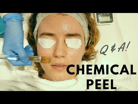 Video: Si ta trajtoni lëkurën tuaj pas një peeling kimik