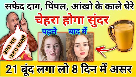 दाग धब्बे पिंपल चर्म रोग | चेहरा होगा सुंदर बस 8 दिन में | pradeep Mishra ji charm rog upay