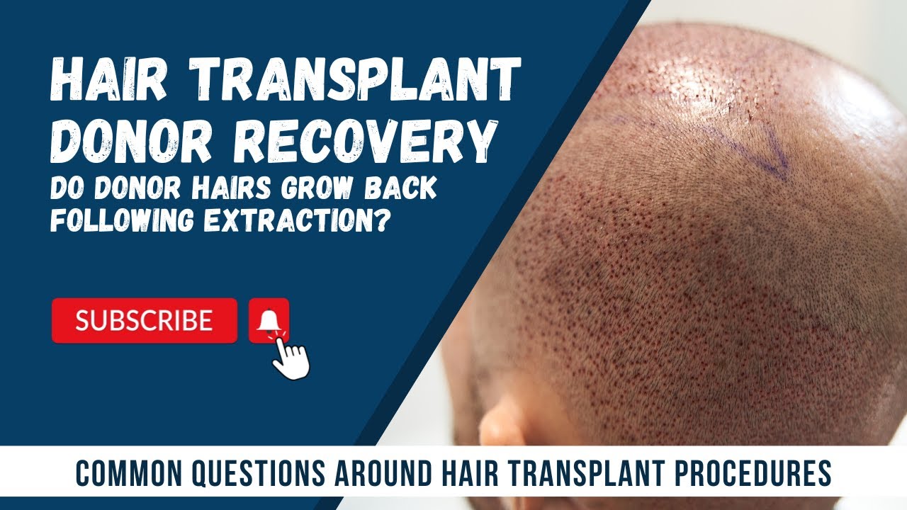 Donor Area Recovery Hair Transplant Do the hairs grow back after