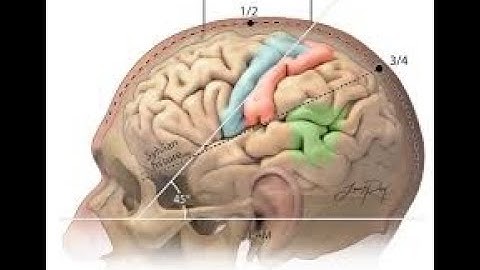 Craniectomy with foreign body removal from brain CPT code - simplify medical coding
