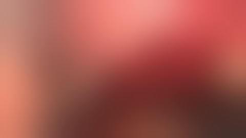 Dr. R. Crespi - Abutment extraction with Magnetic Mallet