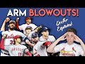 ARM BLOWOUTS! Doctor Intro to UCL and Tommy John Surgery