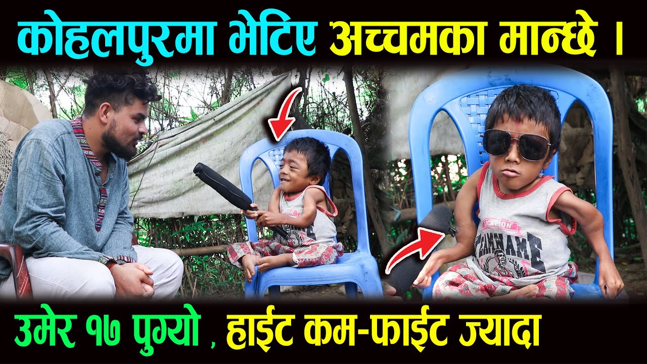 रमाइलो भाई लास्टै हसाए । उचाई सानो उमेर 17 पुग्यो। Funny Video