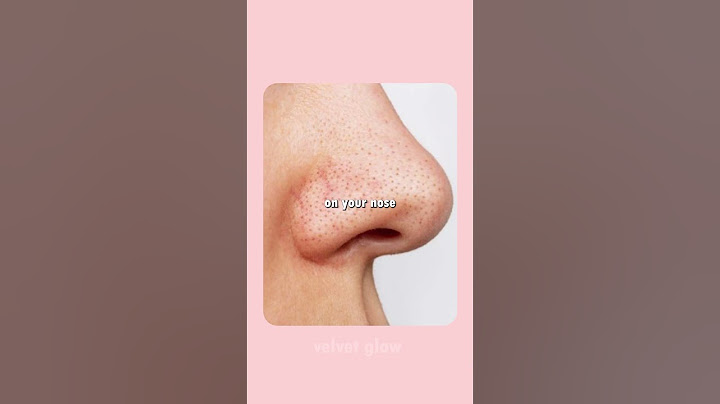 💖 The Vaseline Beauty Hacks EVERY Girl Needs! ✨ #shortsviral