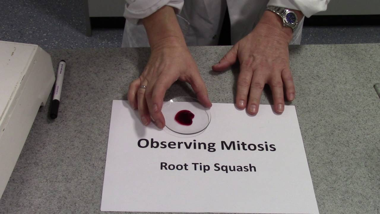 Mitotic Index Root Tip Squash