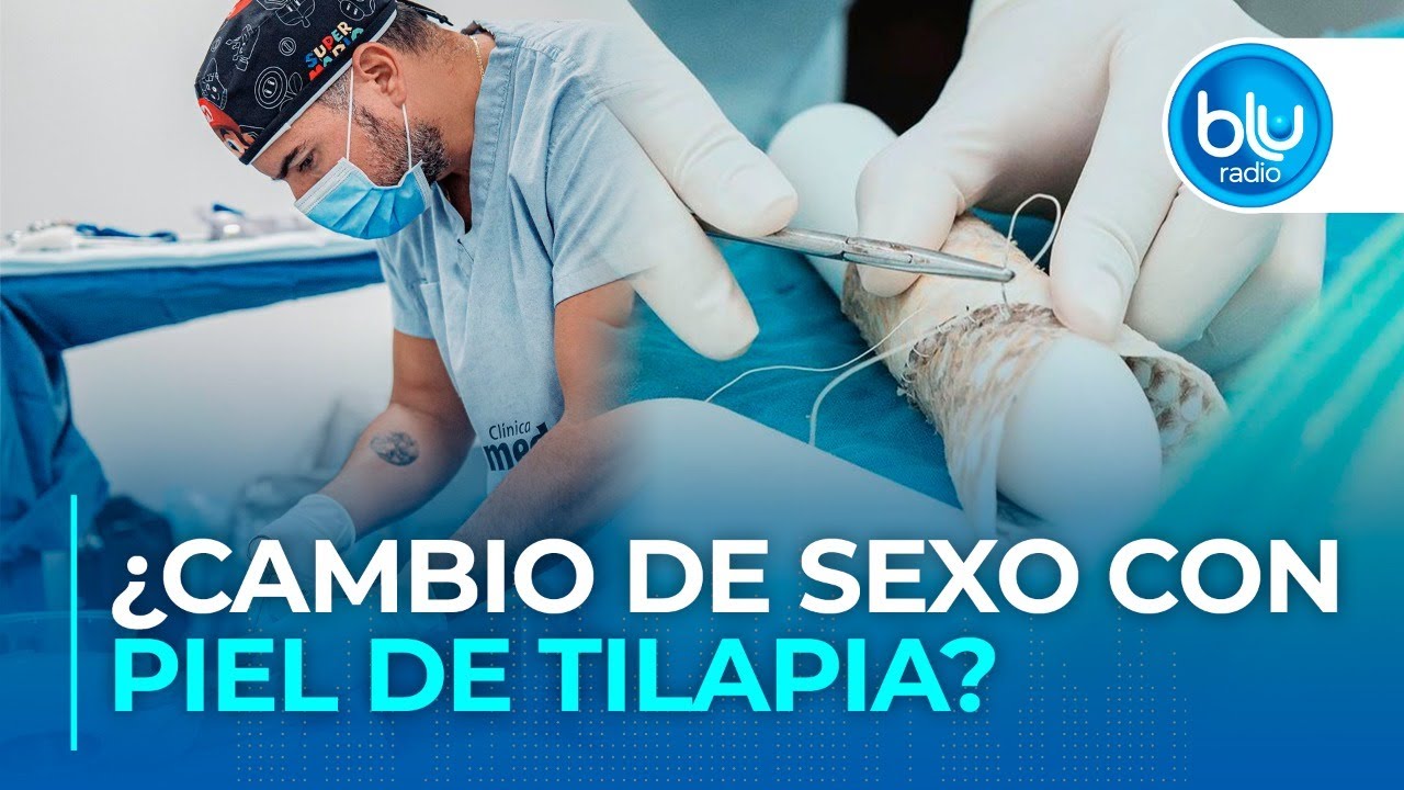 El Dr. Álvaro Rodríguez explica en qué consiste el cambio de sexo con piel de tilapia