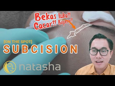 Video: Apakah vasokonstriksi merupakan umpan balik positif?