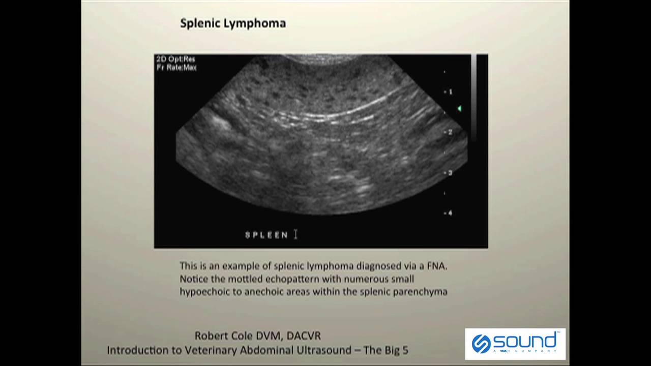 Normal Spleen Ultrasound