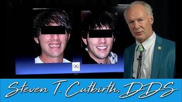 Full Mouth Reconstruction - Dental Minute with Steven T. Cutbirth, DDS