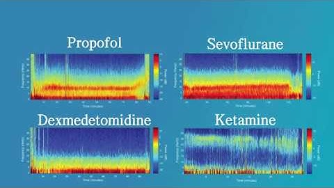 EEG for Anesthesiology - Part 1: Introduction to the EEG for Anesthesiology