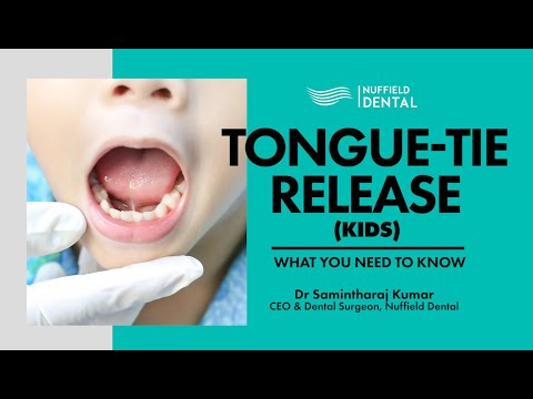 Tongue-Tie Release for Kids: What You Need To Know