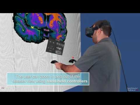 VBS - Virtual Brain Segmenter
