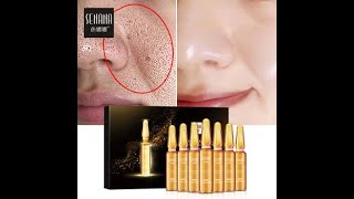 SENANA Face serum skin whitening serum  Anti-Aging essence Shrink pores Hydration skin care