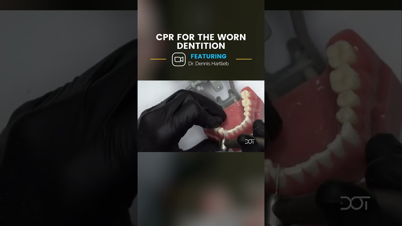 CPR for the Worn Dentition | Dental Online Training 