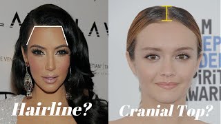 How does Hairline & Cranial Top affect Hairstyles?